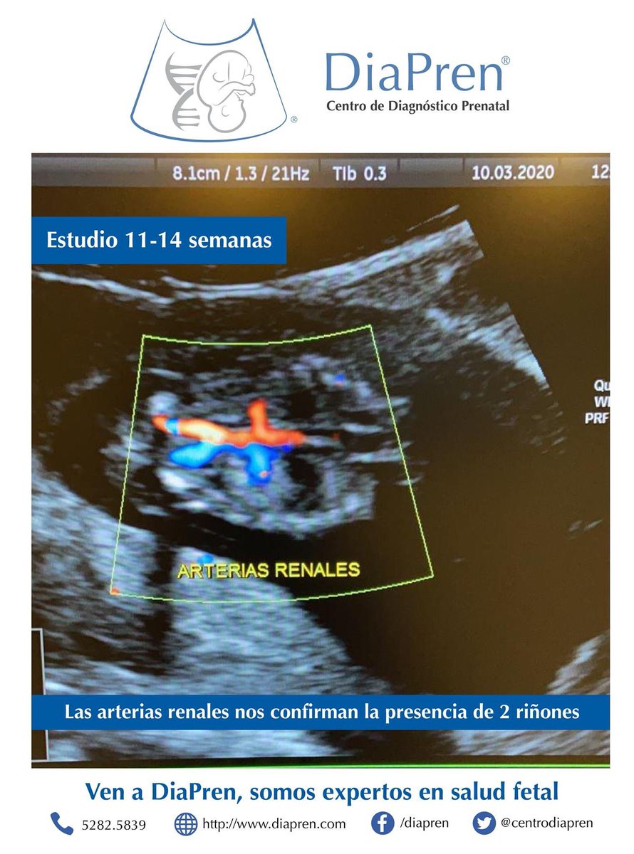 centrodiapren's tweet photo. #ArteriasRenales nos confirman presencia de 2 #riñones

Si estás #embarazada #VenADiaPren!, somos expertos en salud #maternofetal y #diagnósticoprenatal

📞 Citas 55.5282.5839

#fetal #ultrasound #diapren #ultrasonidoestructural  #laslomas #lomasdevirreyes #lomasdechapultepec https://t.co/094CIrzAR7
