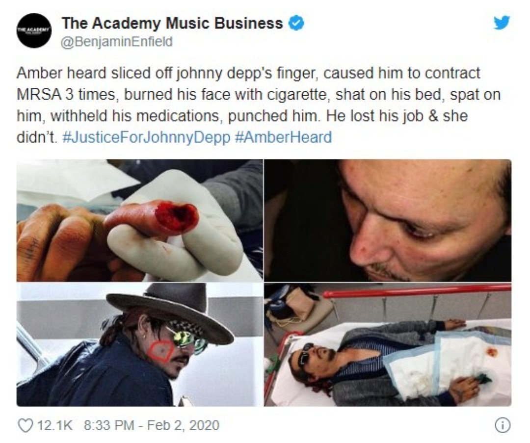 sunshinelouis's tweet photo. TW // domestic abuse 

the fact that I have not seen one tweet on my tl showing support to johnny pisses me off. he is a victim of fucking abuse and crickets.
oh I forgot, he only matters to a majority of you when he offers his talent for your entertainment.
#JusticeForJohnnyDepp https://t.co/H7breRjumr