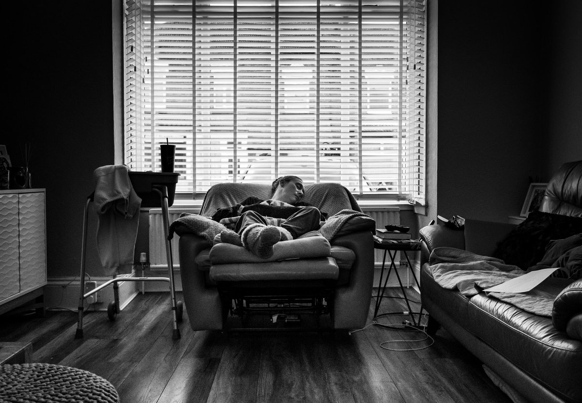 The effects #Dystonia can have. #dystoniaawareness 😞