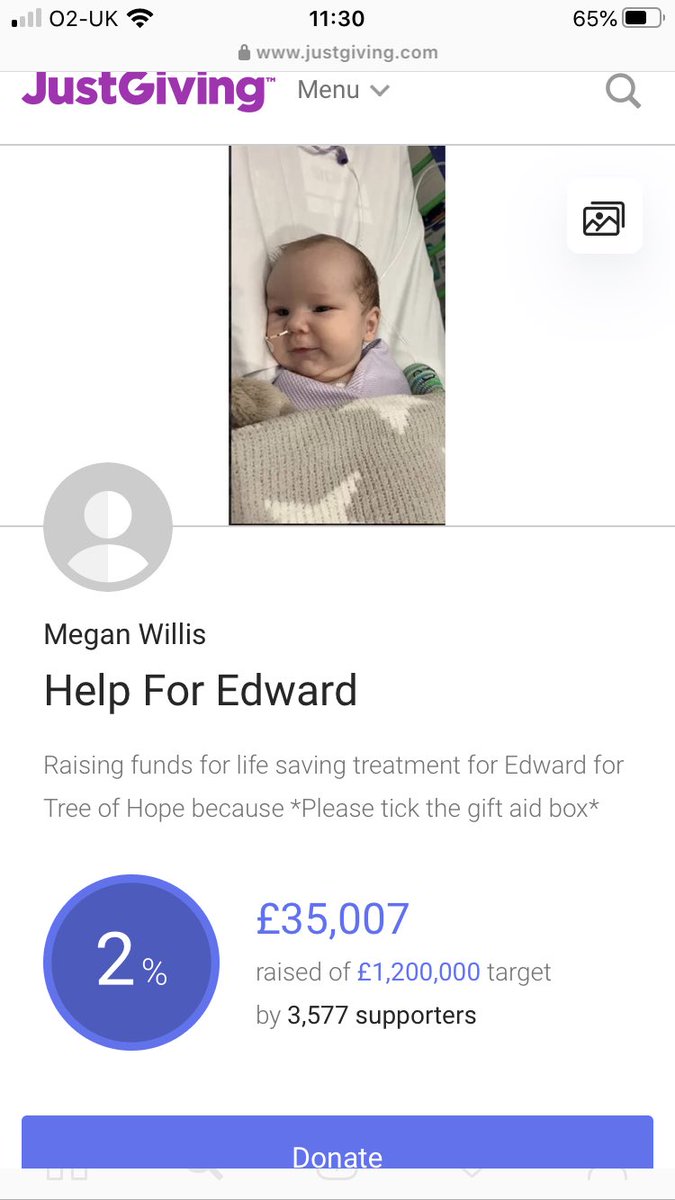 HazelWarne's tweet image. Please please follow and share Edwards page it’s down to many amazing people and the power of social media that this amount has been raised in just 8 days! Please help us help him 💙 #helpforedward