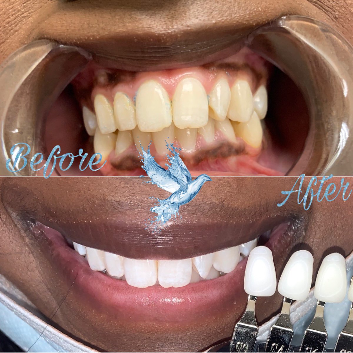 Kaijj4's tweet photo. Hey Guys👋🏾 My name is Kaijha! I’m the Owner of Kleansed Beautyy 🕊🤍My Black Owned Business offers TEETH WHITENING &amp; TOOTH GEMS. 🦷💎It cost $0 to RETWEET this post you never know my next customer may be on your tl.😘 Located in Kenner, Louisiana(ALSO TRAVEL) IG:@kleansedbeautyy https://t.co/x04xXlgqnk
