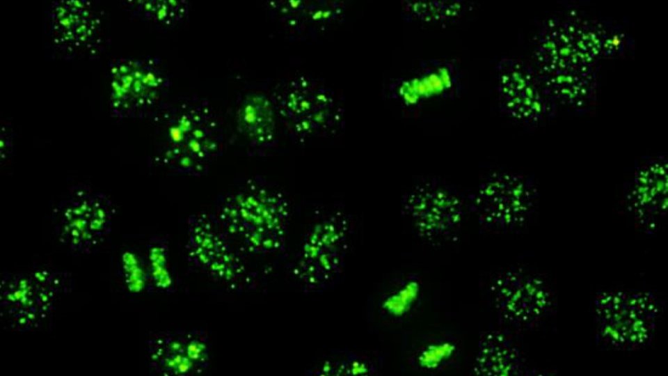 chemistryminute's tweet image. A #beautiful #picture for your day. #Interphase cells: evenly spread granules over the nucleus; #Metaphase: a ribbon-like arrangement; #Anaphase two parallel ribbons approach the centrioles. Do you know the clinical association? #centromere #immunofluorescence #autoimmunedisease