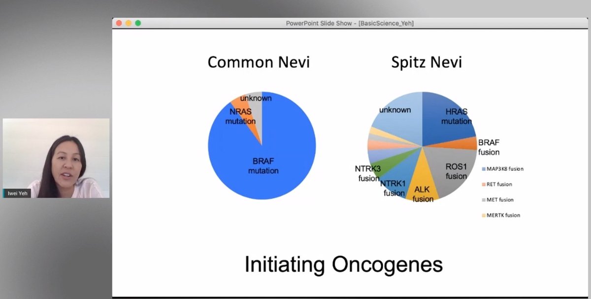SimonRoyMD's tweet image. Some highlights of #ASDP2020 Translational Dermatopathology, lecture by my great research mentor Dr. Iwei Yeh who is truly advancing the field of melanocytic neoplasia. Clarifications regarding Spitz versus Spitzoid, and results from her Spitzoid versus Spitz melanoma recent pub.