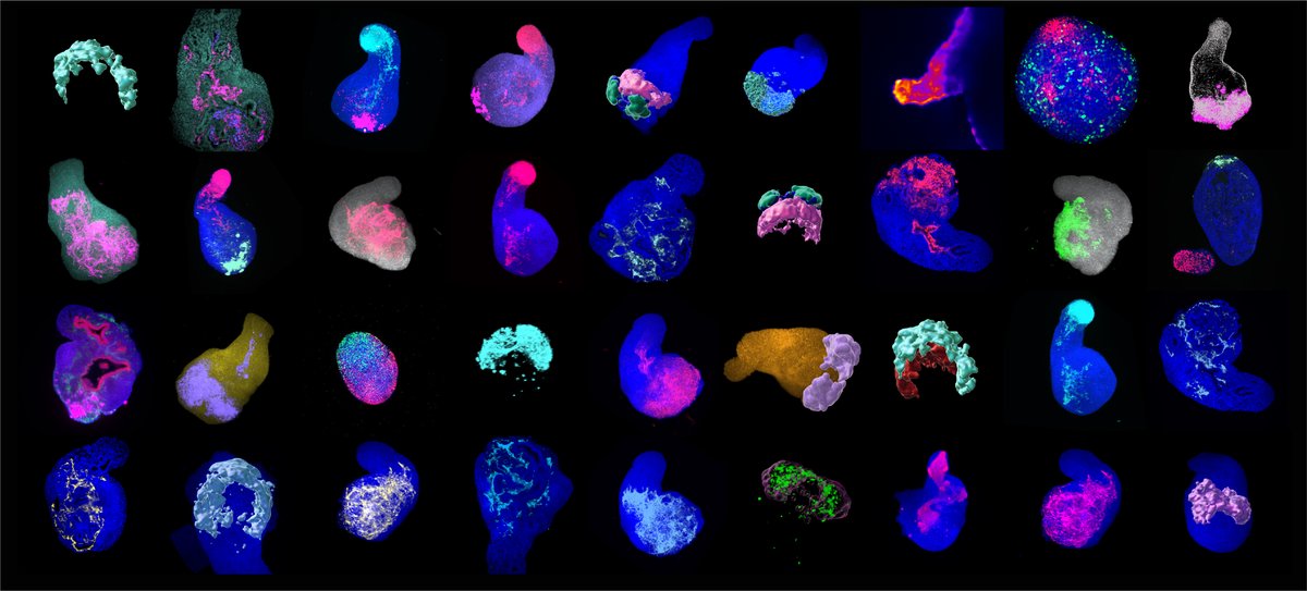 Matthias Lutolf (@thelutolflab) on Twitter photo From gastruloids to organoids: our study on modelling cardiogenesis with ESCs just published <a href="/CellStemCell/">Cell Stem Cell</a>! Check it out: authors.elsevier.com/a/1c2sX6tu0Cbo… Fantastic work by <a href="/Giuliana_Rossi_/">Giuliana Rossi</a> and collaborators! #gastruloids #embryoids #organoids From gastruloids to organoids: our study on modelling cardiogenesis with ESCs just published <a href="/CellStemCell/">Cell Stem Cell</a>! Check it out: authors.elsevier.com/a/1c2sX6tu0Cbo… Fantastic work by <a href="/Giuliana_Rossi_/">Giuliana Rossi</a> and collaborators! #gastruloids #embryoids #organoids