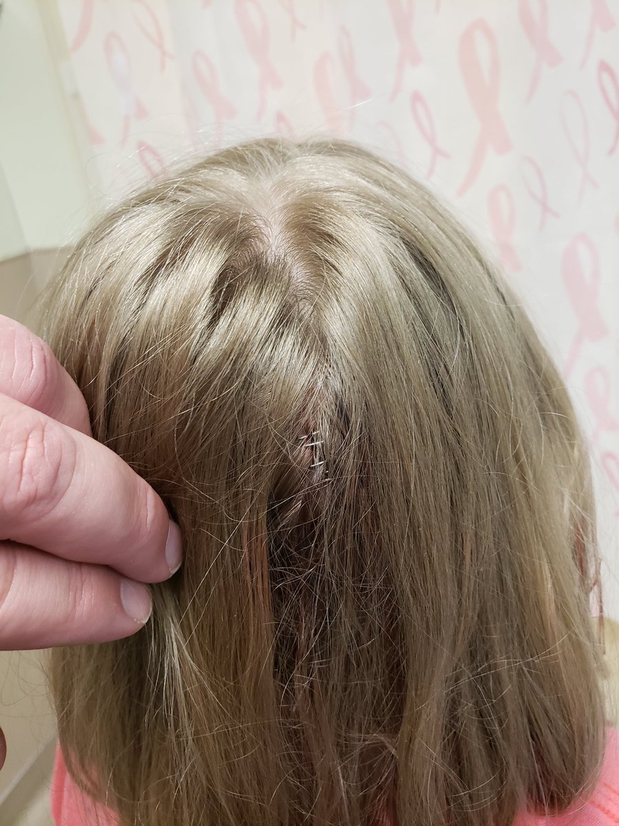 raisingGJ's tweet photo. GJ finally got her staples out today.  Now chasing her around with a torch and pitchfork just feels so...I don't know...unsatisfying. https://t.co/3hW45tc7Sl