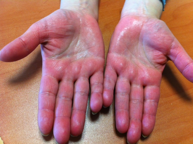 ValriedeMontau1's tweet photo. En exclusivité pour la Dépêche82 : Les mains du directeur de l'ARS de #TarnetGaronne  prises en photos 2 heures après l'annonce  par #BrigitteBarèges de l'ouverture des commerces non alimentaires.
<<J'ai frappé ma table de bureau durant 2 heures, je ne pouvais pas me retenir >> https://t.co/xnAY57kFRj