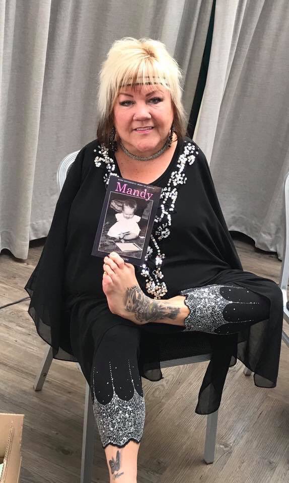 MandyToes's tweet photo. @romankemp let me talk about my life’s story born different but born to survive on ur Sunday Best show with ur dad @realmartinkemp 🙏😜🙏 my book MANDY lets peeps read about me being born without arms due to Thalidomide. Its travelling the world😜🤪🤩 https://t.co/PhcIRuvHf6