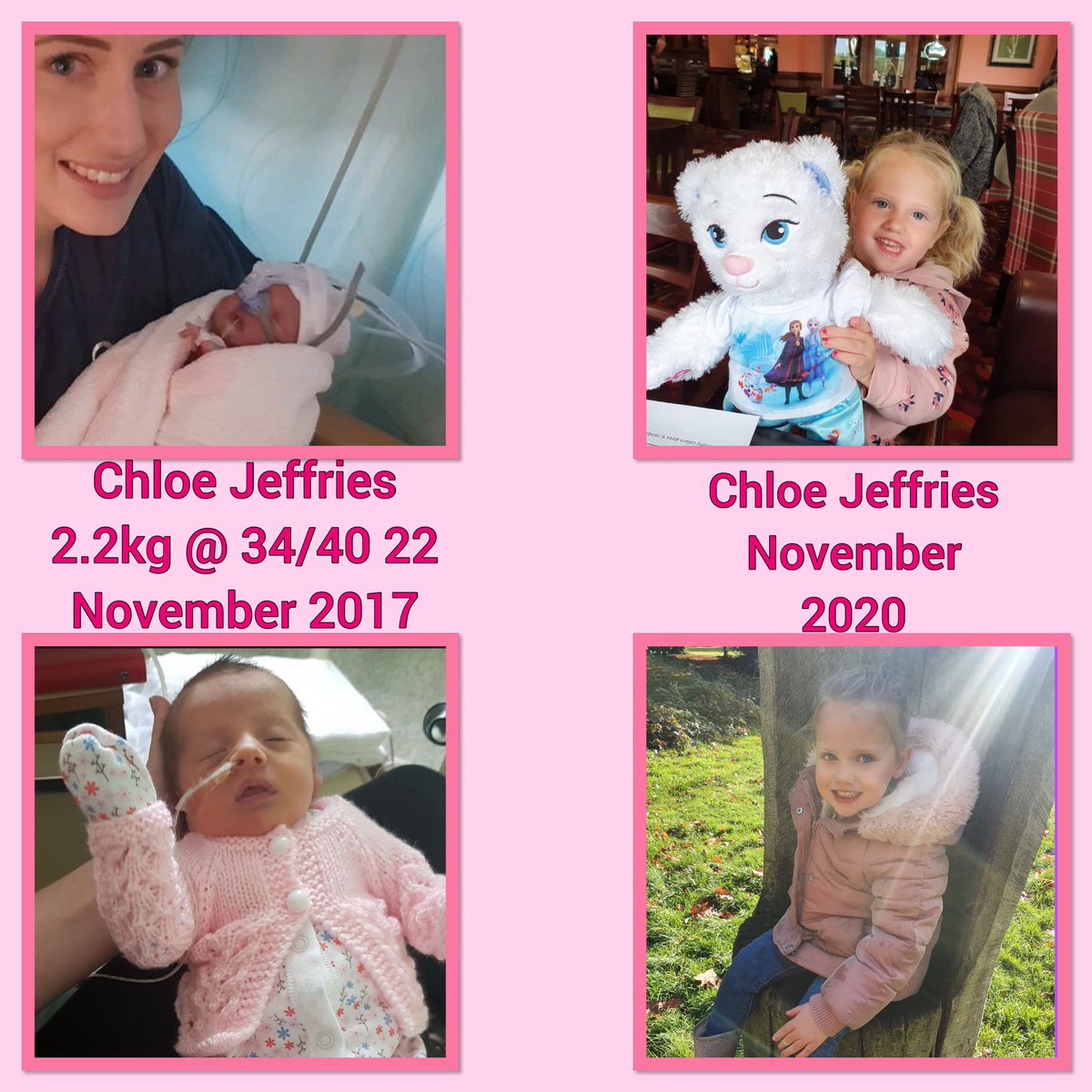 EmillieGibb's tweet photo. @MFT_SMH @AlisonODoherty2 @EatonKath @HeapPenny @ngozi_ediosagie @ChrisAshworth10 @PipRanson Shared with permission from her midwife mummy Leanne Hobbs. Chloe Elizabeth Jeffries born at Wythenshawe hospital in November 2017 #lookatmenow #scbubaby #neonatalunit ๐ https://t.co/RQh30fVH9G