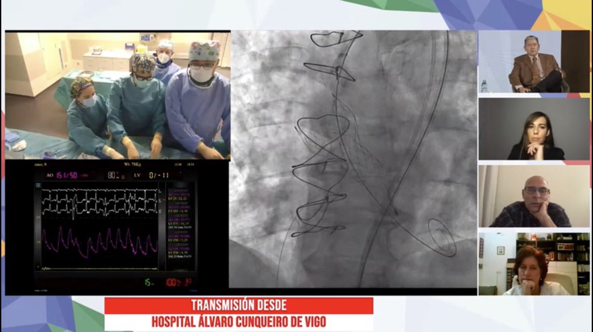 belcid7's tweet photo. Tips and tricks en procedimientos valve-in-valve y bicúspide #CSCWeek Enhorabuena a los operadores por la excelente resolución de casos complejos #JoseAntonioBad @ramirotrillo #victorjiménez @RaulmorenoMD @OjedaOjeda18 @icruzgonzalez #victorjiménez @CSC_interv @shci_sec https://t.co/EqAmB5nCbK