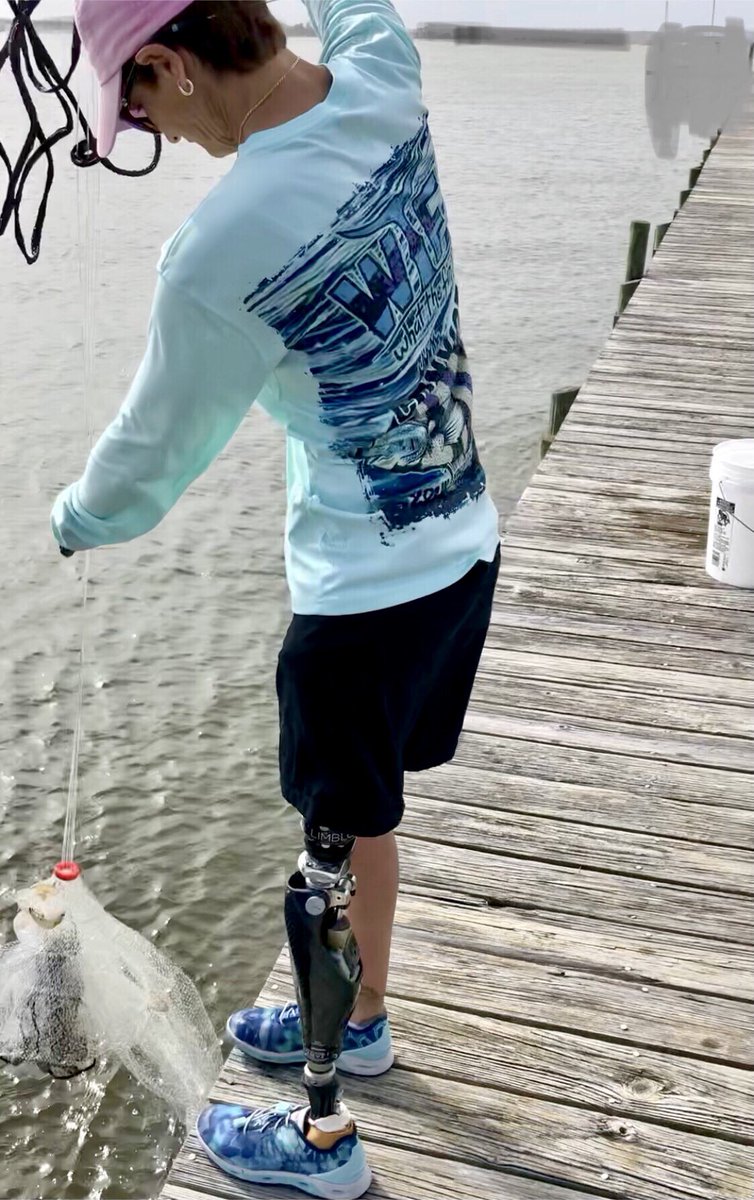 NoLimitsCharter's tweet photo. With the ENE wind still snorting, I decided to throw a small net on the shrimp skipping out of the water!! Also great way to troubleshoot the prosthetic socket. #amputeelife #whatthefin #weareopc @OPCenters @OttobockUS_CA #freshshrimp #castnets #shrimp #ladyangler ๐ฆ๐ฆฟ๐ค๐ช๐ https://t.co/aBTstUD94Y