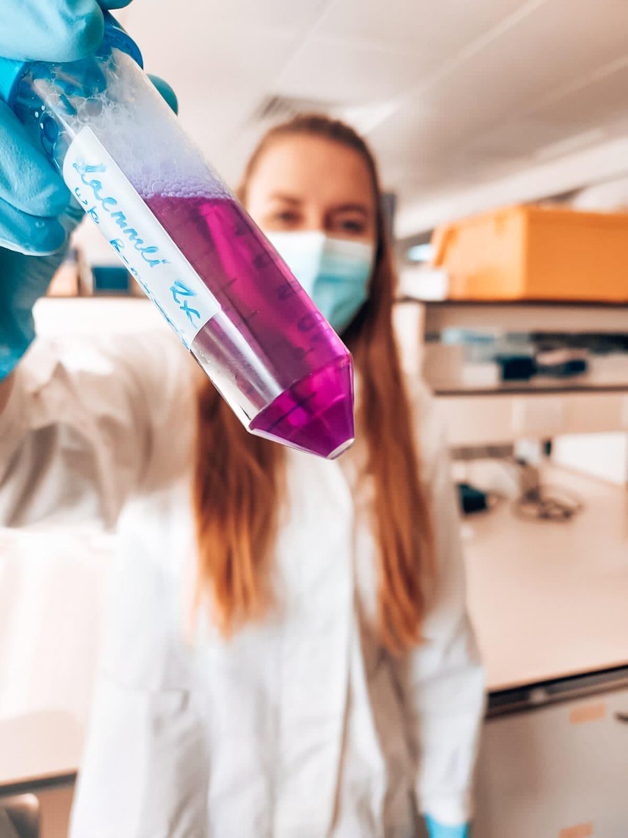 asctntraining's tweet photo. Hi all, I‘m Nina, ESR 2!
I come from Germany and I am doing my PhD at Cardiff University! 🏴󠁧󠁢󠁷󠁬󠁳󠁿
My PhD is all about Microglia, the immune cells of the brain, and how they are affected in Huntington’s disease. 🧠🔬

#neurodegeneration #phdlife #MSCA #asctn https://t.co/CZh50S5SyS