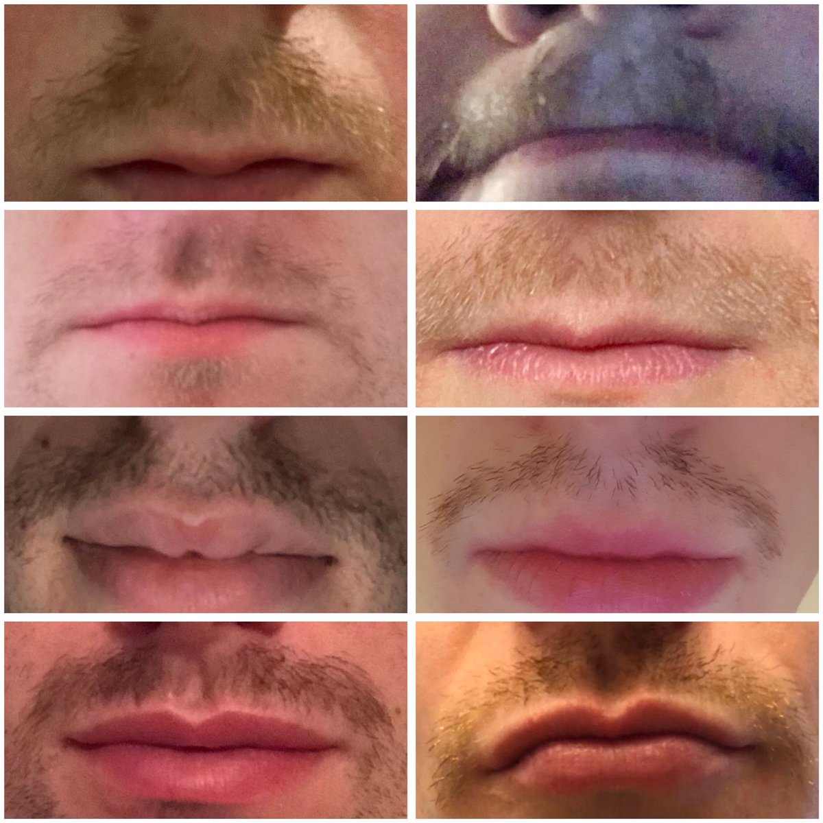 Movember Update - 10 days deep into the growth. Time for a game of guess that squache. All Squaches have played for Scotland and are under 40 years of age. If you’re feeling generous donate on our newly formed #ScottishSquache Page #Movember #JustFirALaugh movember.com/m/14497532?mc=1