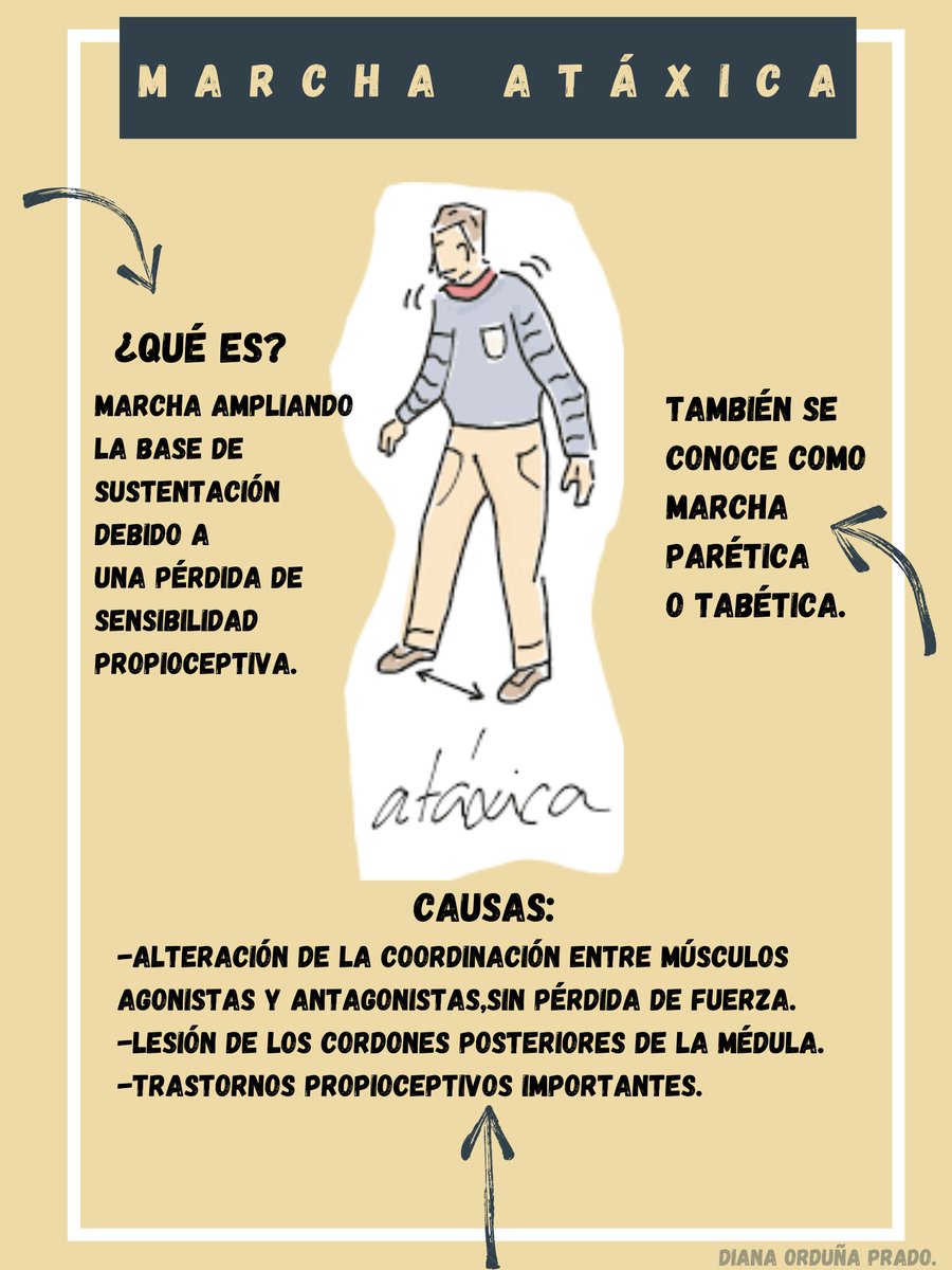 nanisbubble_90's tweet photo. 🚶•MARCHA ATÁXICA•🚶

@Karla_LP20 https://t.co/4XVtIX2edU