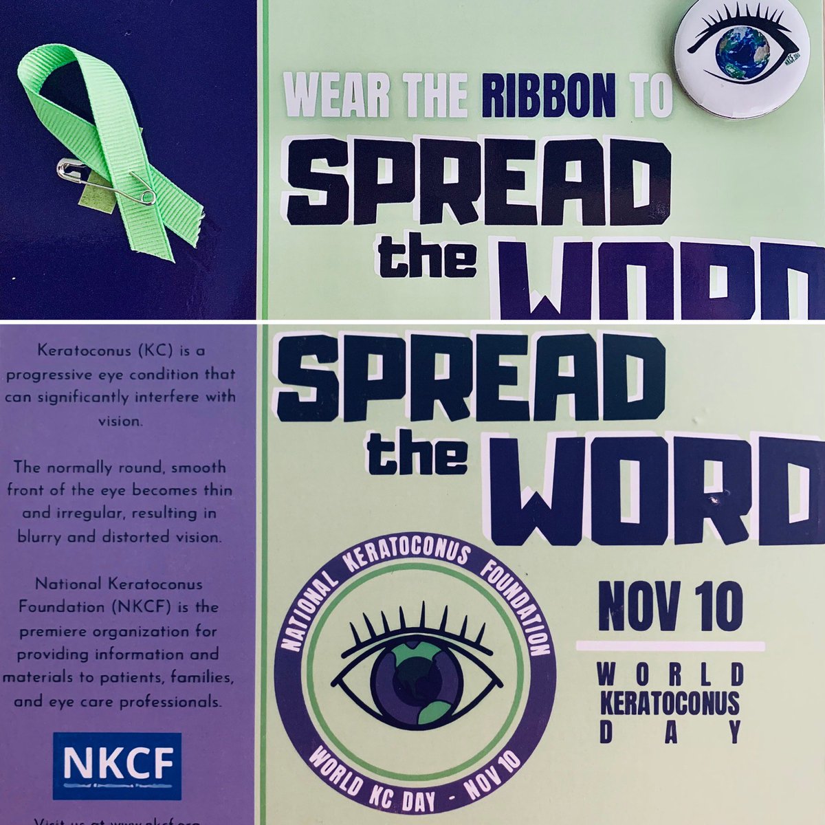 Did you know Nov 10th is “World Keratoconus Day”? Whether you have KC ribbon on or not, pls  consider supporting NKCF (bit.ly/2UemSyh) &amp; promote awareness of this visually debilitating condition. Join me in supporting NKCF &amp; #keratoconus patient on this important day!