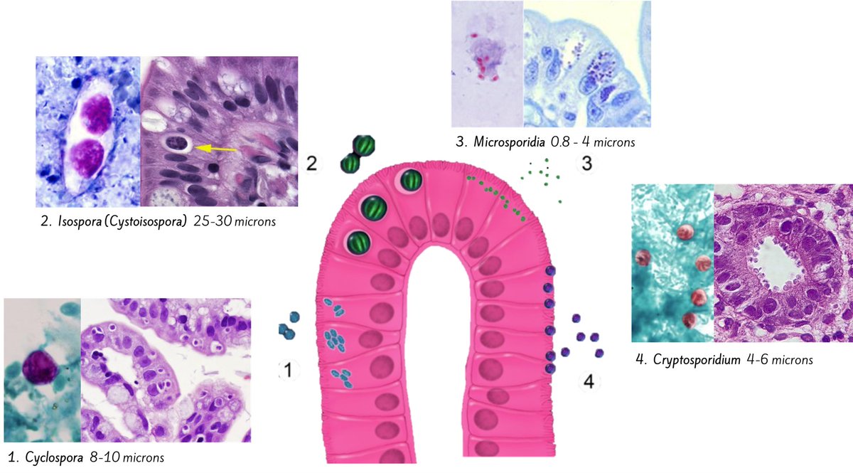 CharlottesWebMD's tweet photo. In my panic to cram micro for #pathboards, I made a chart using images from ExpertPath and others I found online to help keep myself organized. Please use the below diagram of sporidium of the GI tract if it helps you! #GIpath https://t.co/q7rjt8gD2t