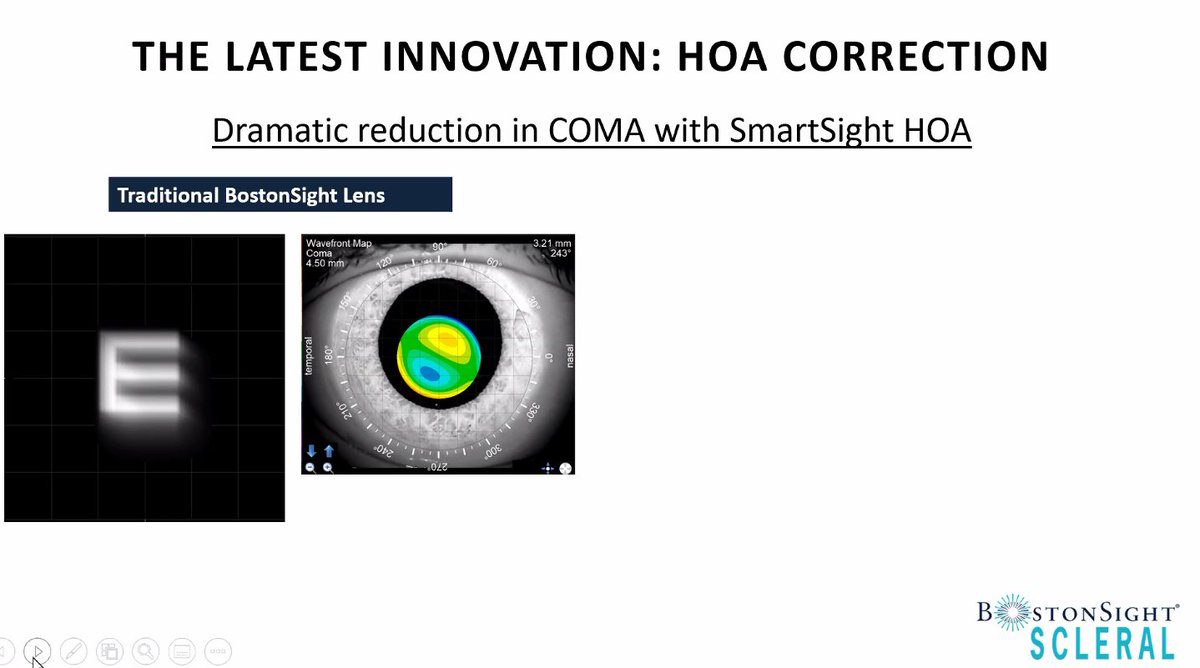 Our latest available innovation - #HOA correction. #SmartSight #optometry #sclerallens