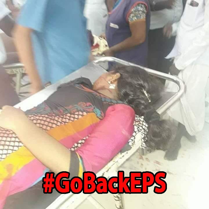 RahulB19919258's tweet photo. #GoBackEPS https://t.co/Fexnu1uC7Q