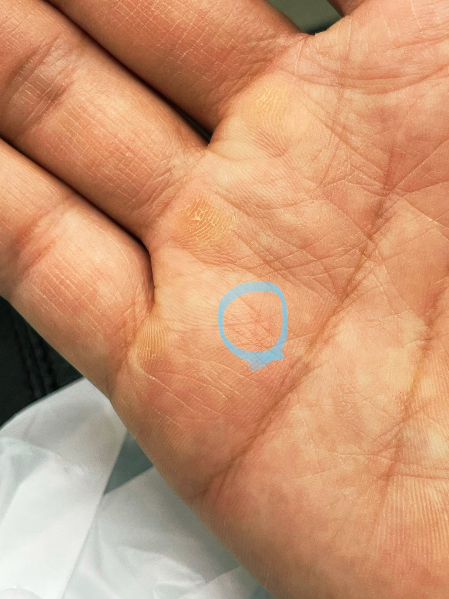 久保田秀敏 よく見たら右手にもう1個あった 手相 スター線 合計3つ なんかいい事あるかな T Co P3nhzzt9di Twitter