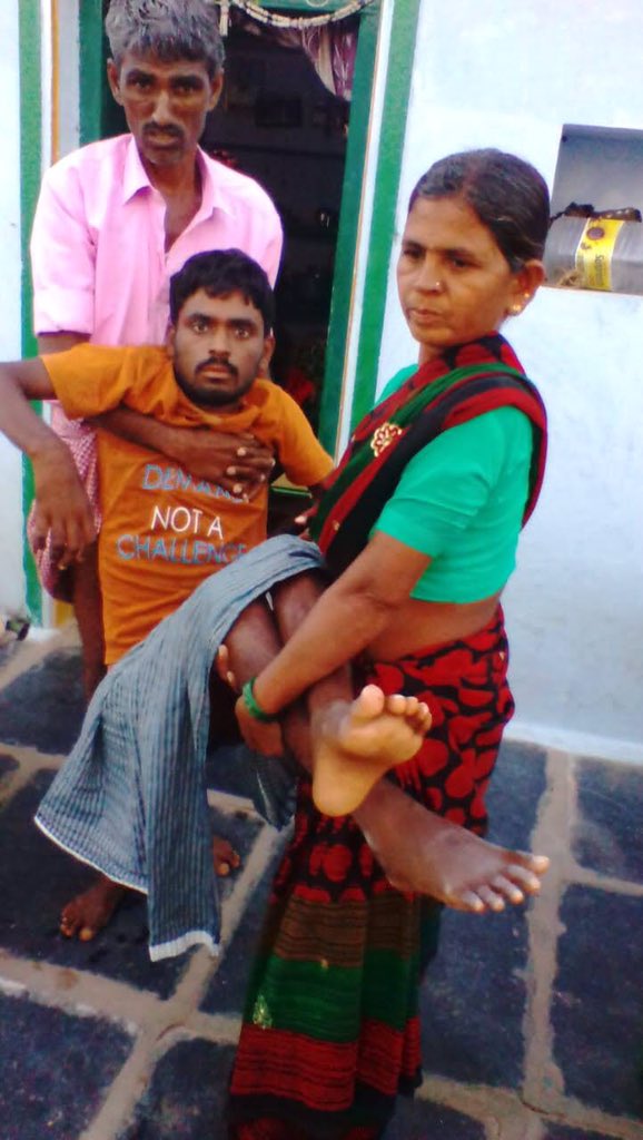 siddusss's tweet photo. @pspskjanasena once visit Tirupati BIRRD hospital (TTD)
Gudur Jagadeesh earlier he is with BIRRD now he is VIRRD director
@sreekanth324 garu please kindly visit VIRRD and explain @VannurappaBurr1 issue,
experts in Spinal injuries and orthopedically handicapped
@PawanKalyan https://t.co/kD46Vu9Ybe