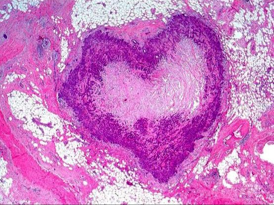 indroneelb1's tweet photo. Happy International Pathology Day....stay safe and keep viewing wonders under the scope🙂✨🔬  #PathTwitter #PathMatch21 https://t.co/KfbEw3gZpa