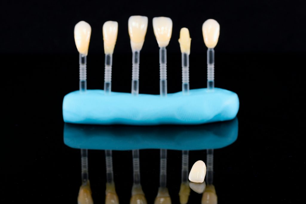 OrchardsScotts's tweet photo. What are #dental #veneers and how do they work? Check out a few interesting facts about them: https://t.co/kOdCFSKvex #smile #invisalign #beautifulsmile #smilebeautiful #teethwhitening https://t.co/398Xhb7Rfl