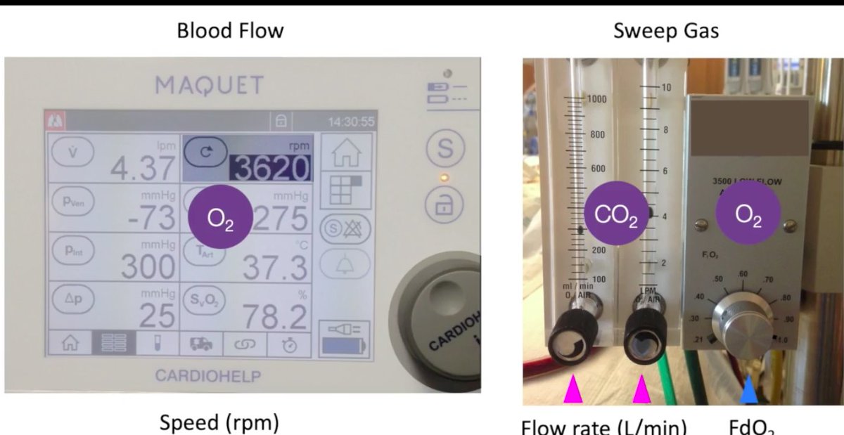 Second and third educational  #ECMO videos published in  @ATSScholar:2) Flow, pressure, hematology & emergencies  https://bit.ly/32wYeNO 3) Gas exchange, membrane lung & ventilator  https://bit.ly/3pjBDhO 