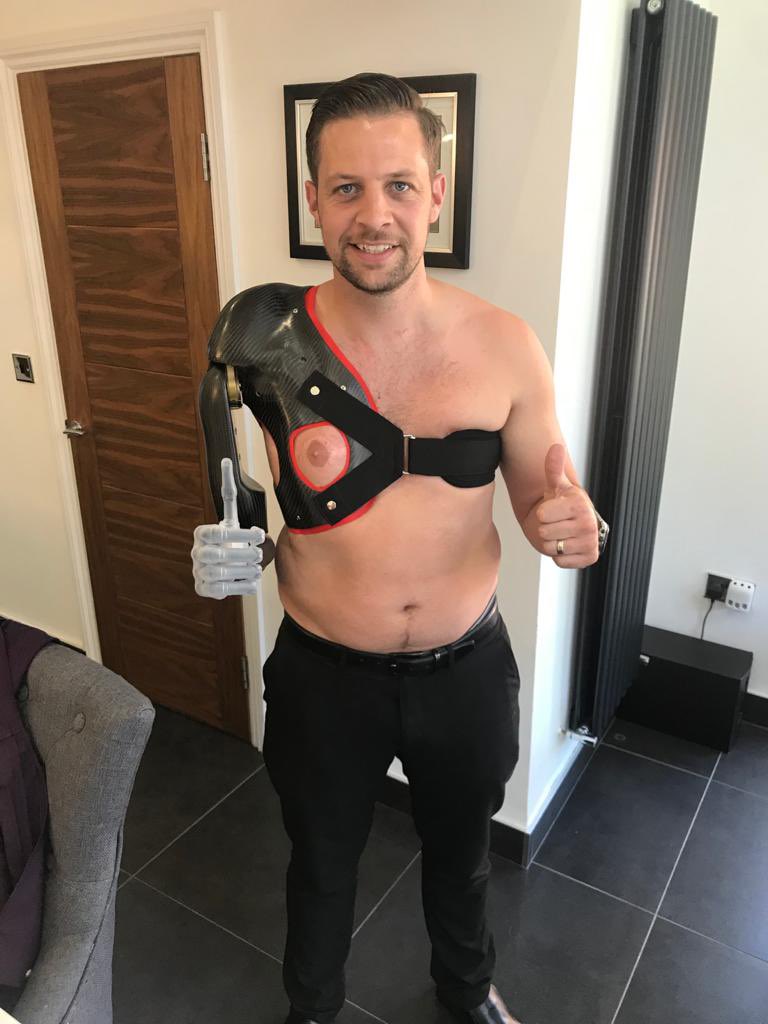 KaileyG87's tweet photo. Immensely proud of my husband today. Hit by RPG in 2010 completely removing his right arm. He has adapted amazingly and our kids love his rotating wrist so much.First one in the UK with a bionic arm #thismorning @thismorning @hollywills @Schofe #ArmisticeDay https://t.co/CAgbob4hBf