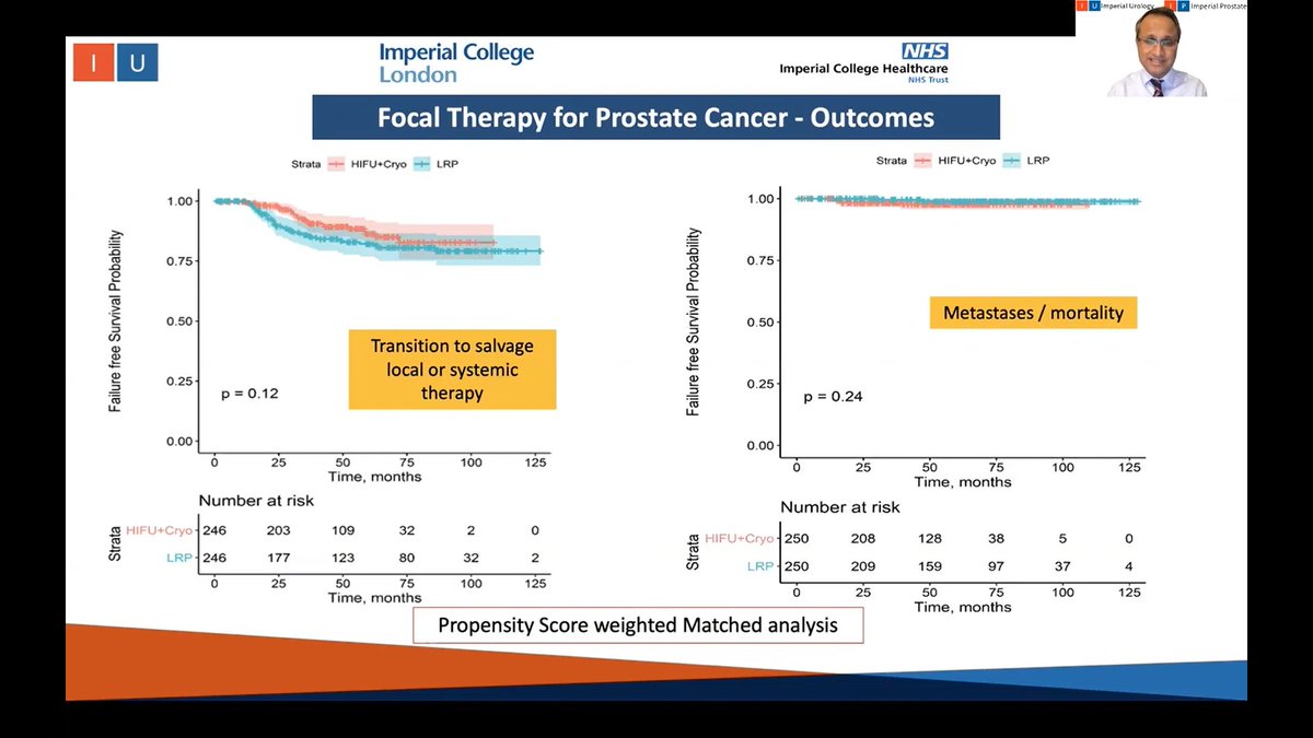 IP_London's tweet photo. Clinical outcomes of Focal Therapy vs. Prostatectomy in JCU Guest Lecture #BAUS20. Propensity matched analysis shows likely non-inferiority with similar rates of 

• Transition to salvage local / systemic therapy
• Metastases / Mortality

@Reddy4Urology @IP_London https://t.co/CZqD4hKLfY