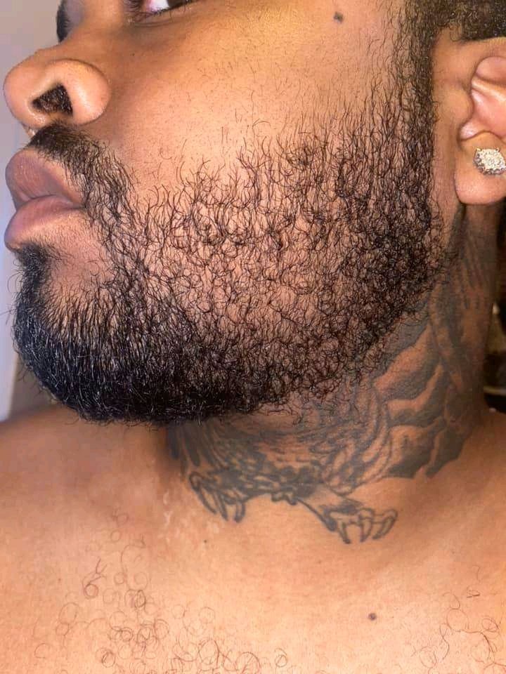Josephguam's tweet photo. Get that beard and fix that hairline.. KIRKLAND MINOXIDIL approved by FDA for curing hair loss and male pattern baldness. It is also very effective for beard growth🔴🚨
✅1400/=
🔴Free delivery within Nairobi CBD
📞📩Contact us 0704512536
Mutahi kagwe #comarcogroupexposed https://t.co/tCOUN1bs6I