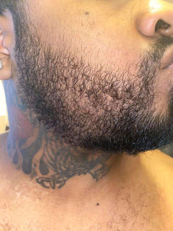 Josephguam's tweet photo. Get that beard and fix that hairline.. KIRKLAND MINOXIDIL approved by FDA for curing hair loss and male pattern baldness. It is also very effective for beard growth🔴🚨
✅1400/=
🔴Free delivery within Nairobi CBD
📞📩Contact us 0704512536
Mutahi kagwe #comarcogroupexposed https://t.co/tCOUN1bs6I