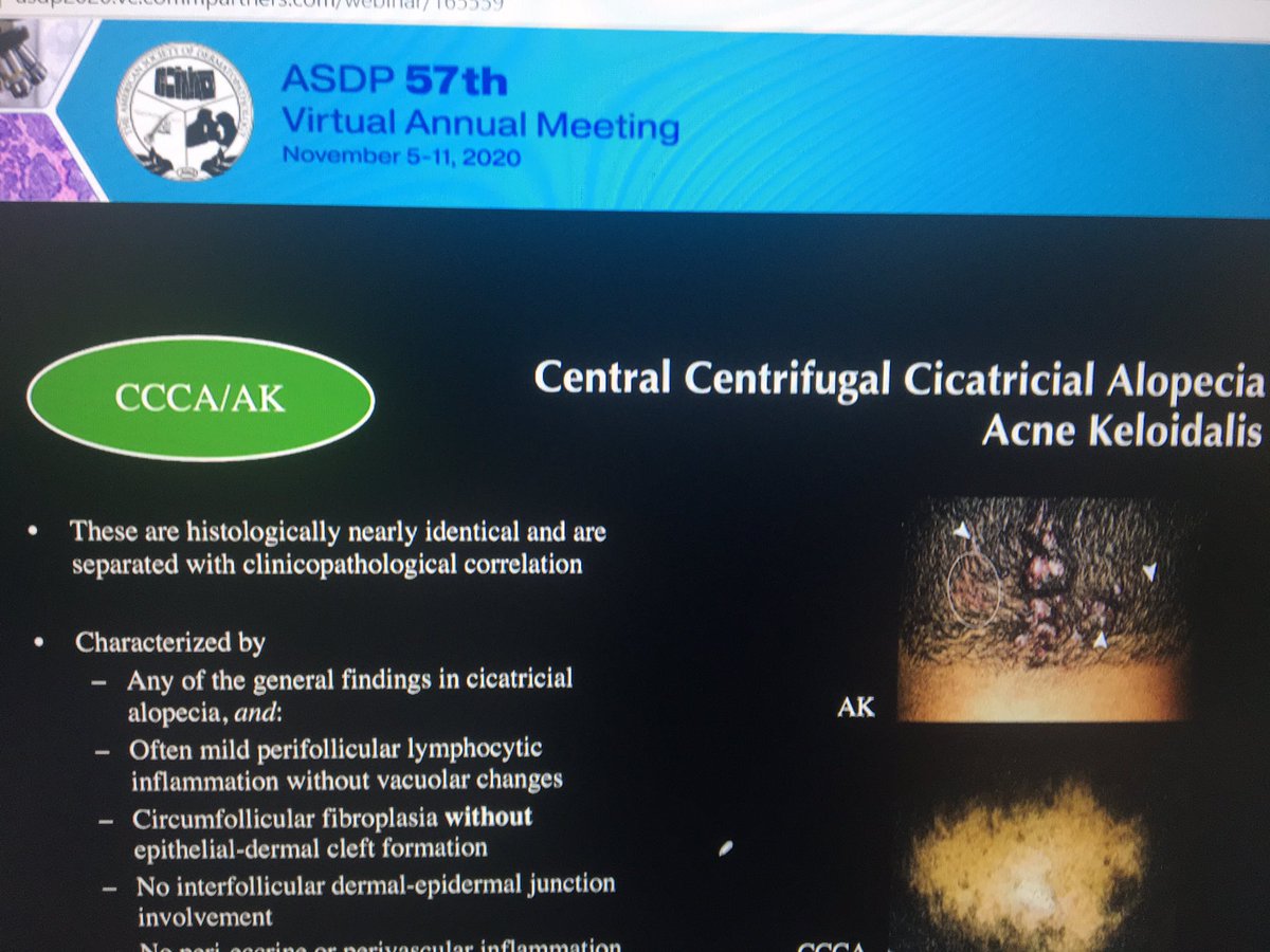 tonitatirado's tweet image. #dermpath #ASDP20 to differentiate from LPP clue: no cleft in CCA