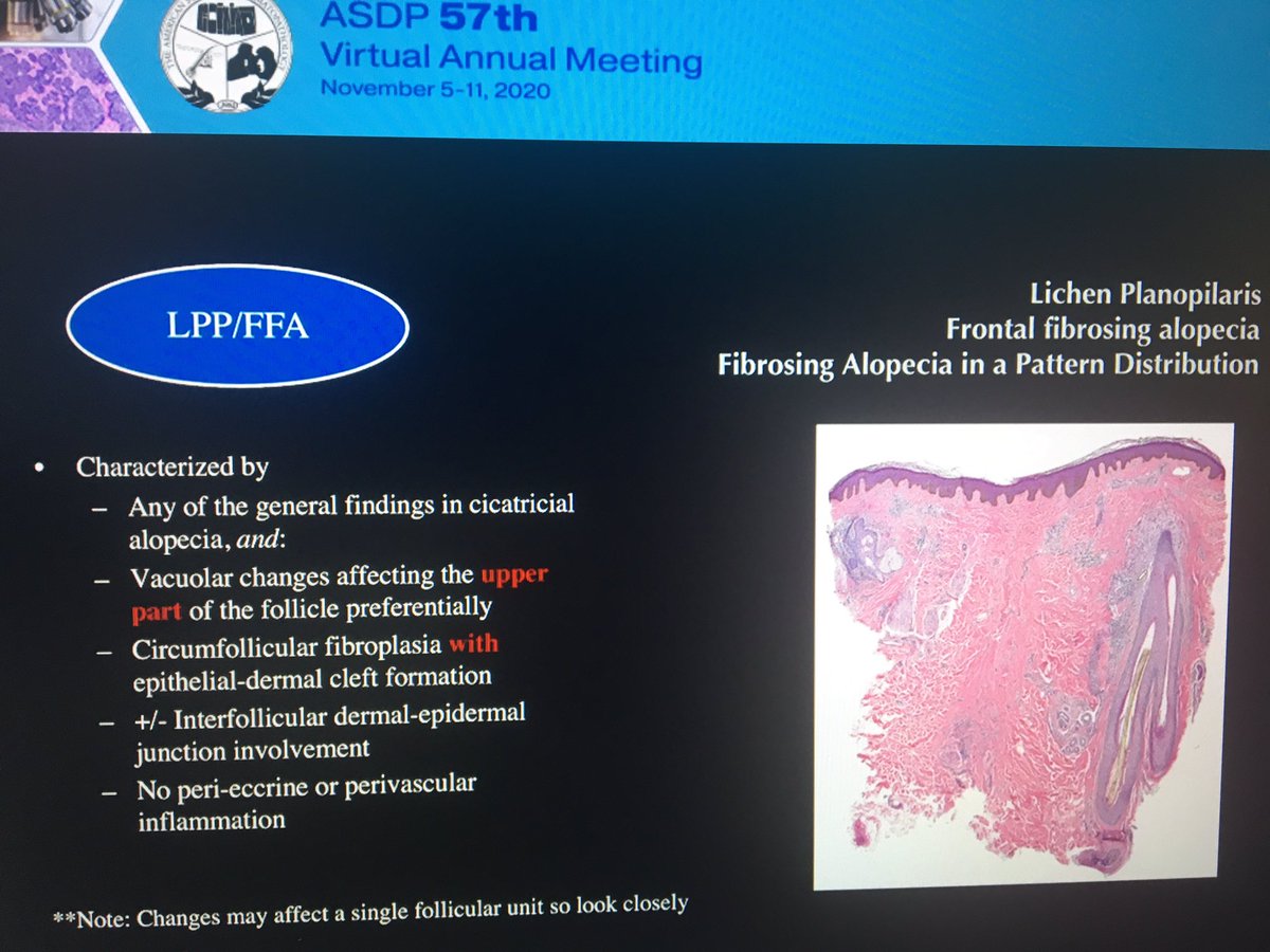tonitatirado's tweet image. #dermpath #ASDP20 to differentiate from LPP clue: no cleft in CCA