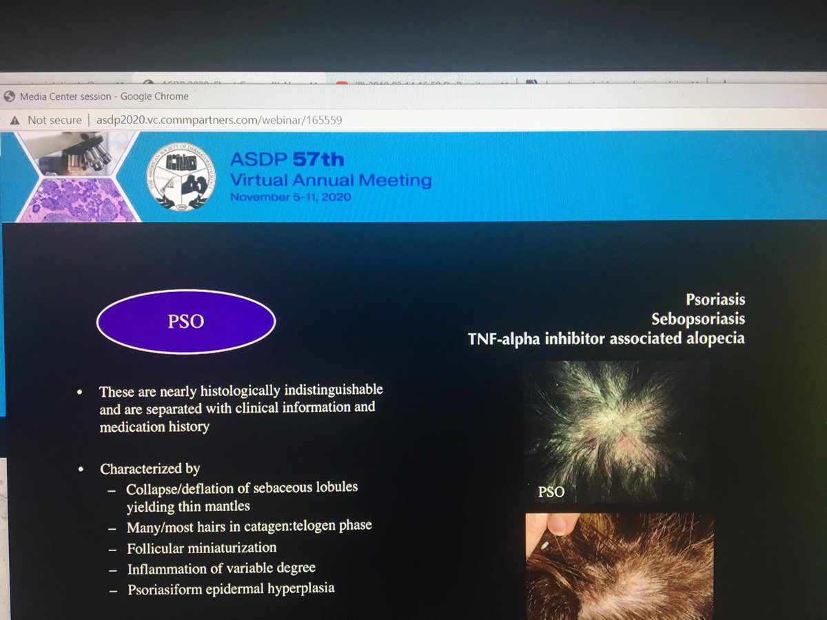 tonitatirado's tweet image. #dermpath #ASDP20 Psoriasiform pattern. Histologically indistinguishable! May be the first presentation in psoriasis and there might not be known history Dr. Cowper
