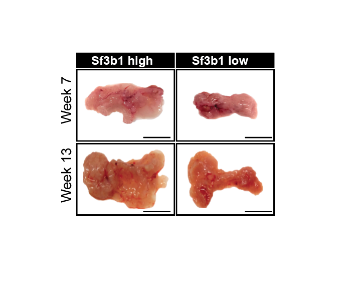 We limited Sf3b1 expression in a mouse model of  #PancreaticCancer, leading to severely reduced tumor growth. This is due to reduced capability of  #cancer cells to adapt to  #hypoxia, while splicing remains functional. The image shows tumors with high and low levels of Sf3b1. (2/4)