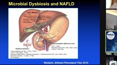 the #microbiome comes out to play! #LiverSIG #PISA2020 #DavidCohen #gutliveraxis #NAFLD