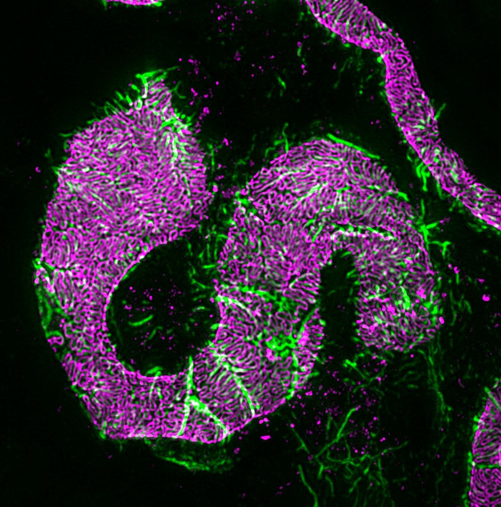 EndlichNicole's tweet photo. Says more than words..... I love super resolution microscopy and podocytes....(magenta:podocin, green synaptopodin)...#nipoka https://t.co/dETlfLPwGP
