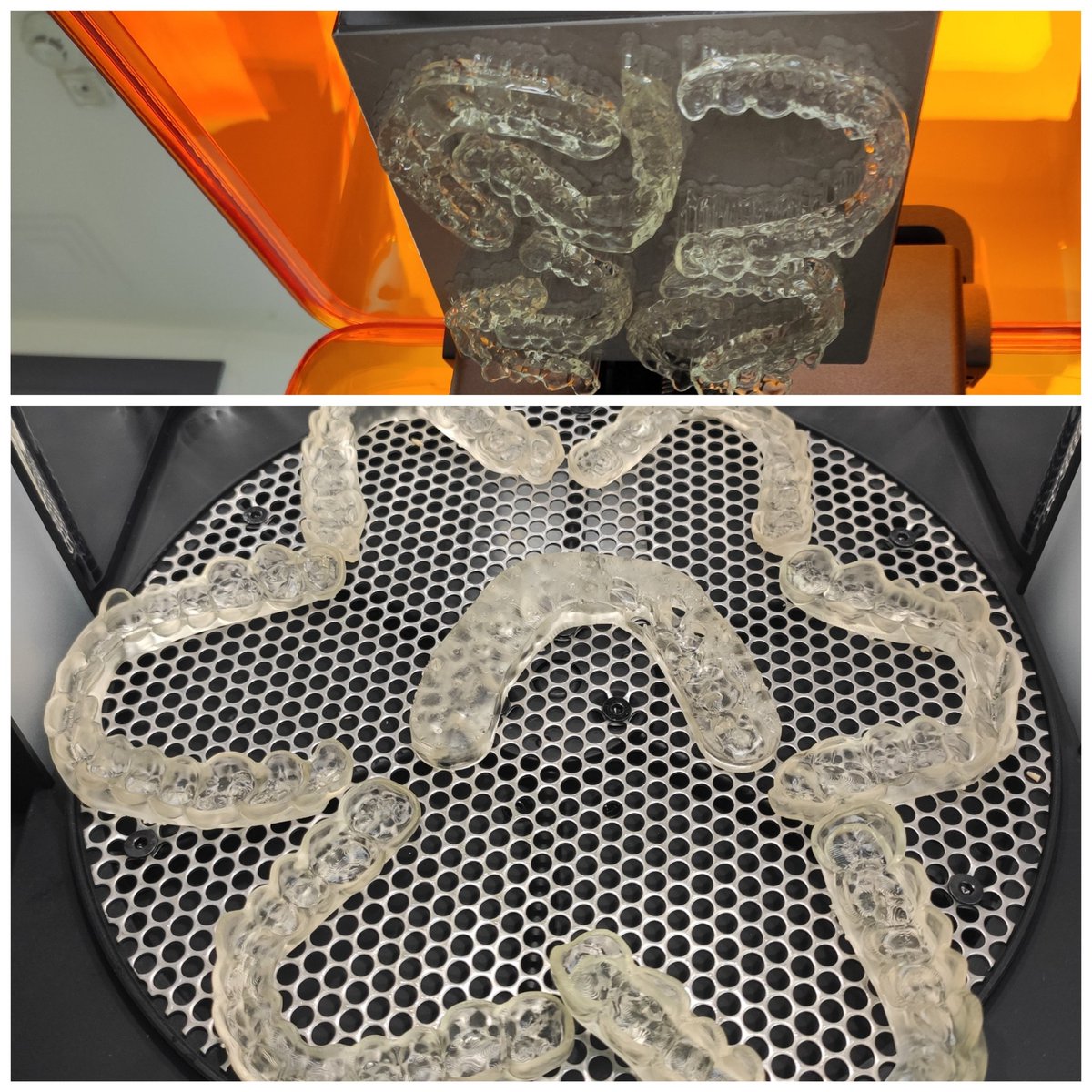 Our splints are out of the # 3dprinter production line, different TMJ splint design approaches and our physicians have added much richness to splints with different demands.We have come a long way together 😎
  #DiigitalTMJSplint #3dsplint
  #Biocompatible #3dprinter
