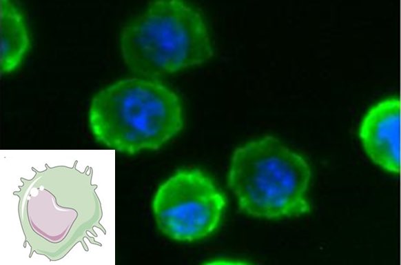 Samir Mitragotri (@smitragotri) on Twitter photo Check out our recent paper in Adv. Mat. on non-genetic modifications of cells by depositing nano-complexes of biomomecules on cell surfaces. Anti-PDL1 nano-complexes on macrophages markedly improved tumor response in mice doi.org/10.1002/adma.2⦠<a href="/wyssinstitute/">Wyss Institute</a> <a href="/hseas/">Harvard SEAS</a> Check out our recent paper in Adv. Mat. on non-genetic modifications of cells by depositing nano-complexes of biomomecules on cell surfaces. Anti-PDL1 nano-complexes on macrophages markedly improved tumor response in mice doi.org/10.1002/adma.2⦠<a href="/wyssinstitute/">Wyss Institute</a> <a href="/hseas/">Harvard SEAS</a>