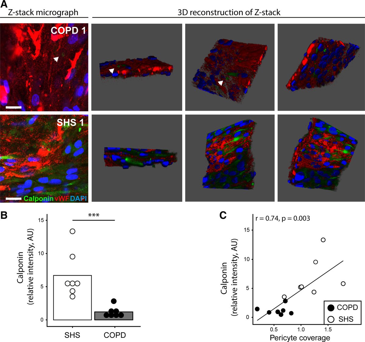 AJP-Heart and Circ (@ajpheartcirc) on Twitter photo FREE Article of the Week shows for the first time that #pericyte coverage of the skeletal capillaries is drastically reduced in patients with #COPD during #exercise training-induced #angiogenesis
ow.ly/7IgA50ChRLa
<a href="/umontpellier/">Université de Montpellier</a> <a href="/LeoBlervaque/">Blervaque Léo</a> FREE Article of the Week shows for the first time that #pericyte coverage of the skeletal capillaries is drastically reduced in patients with #COPD during #exercise training-induced #angiogenesis
ow.ly/7IgA50ChRLa
<a href="/umontpellier/">Université de Montpellier</a> <a href="/LeoBlervaque/">Blervaque Léo</a>