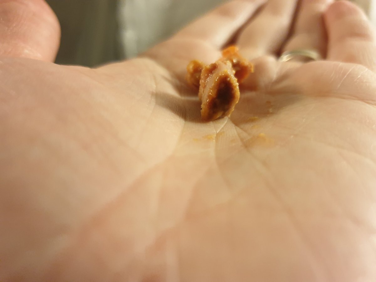 Feeb12345's tweet photo. @Morrisons Hi, who can I contact regarding one of your products, we purchased smoked bacon lardons, it contained some bone fragment which my husband got whilst eating and it's caused a large cut to his mouth, due to him taking Warfarin, it's causing a lot of bleeding. https://t.co/ch4LFfx29b