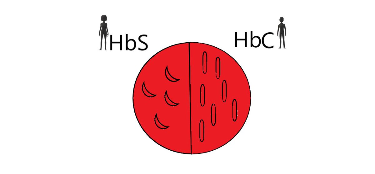 There is another kind of abnormal hemoglobin called hemoglobin C. If a person gets one gene for HbS and one for HbC they have 50% S and 50% C hemoglobin, and are HbSC. The 50% C does not keep them healthy like HbA would, and so they also have sickle cell disease.