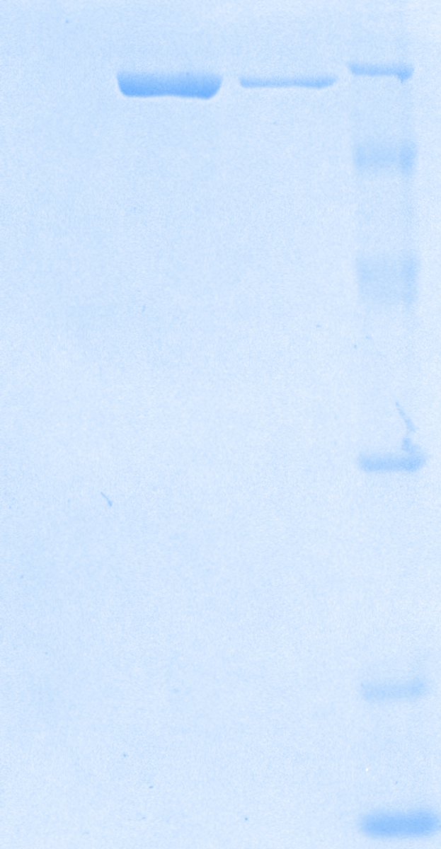 Antonio J Vallecillo, PhD tweet media