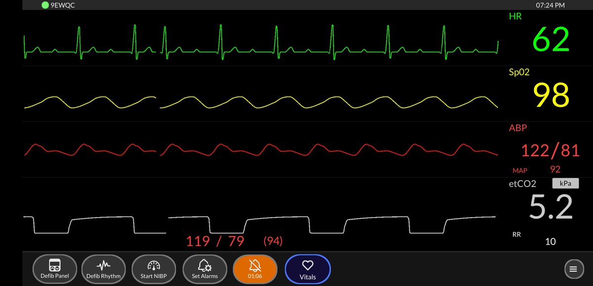 NkwilliamsNw's tweet photo. Getting set for day 3 of ECS this week and it's scenario time....!!!
Mmmmmh Medical v Trauma...??
How poorly will he get before intervention....????
This should keep them on their toes
@EEAST_UrgCare @steve11010770 @tracyniks @antkitchener #saveBryan #BLS #ILS https://t.co/YmnNurSvXo