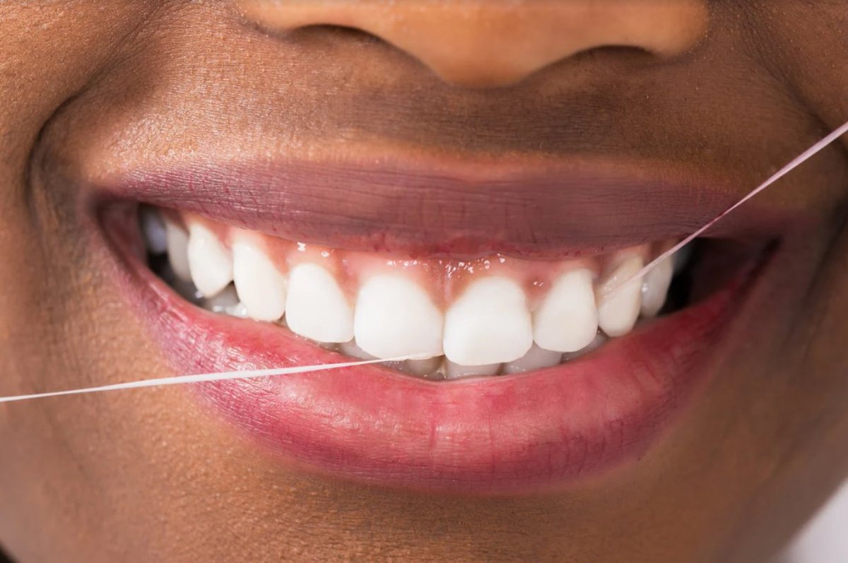 cassondentistry's tweet photo. Don't forget to floss! When you don't floss, you miss cleaning roughly 35% of your tooth's surface. https://t.co/b569N1uTrk