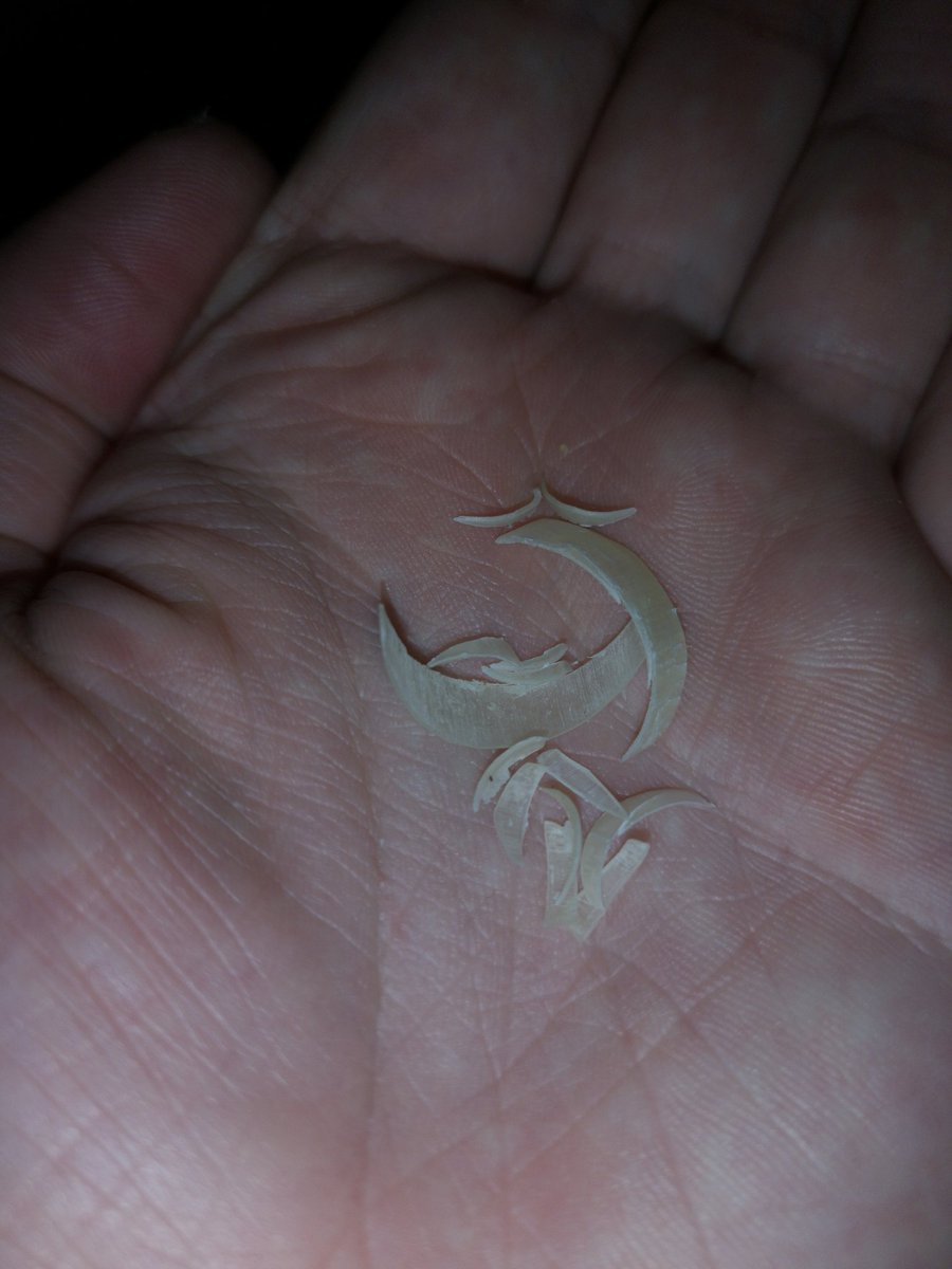 YourFootKing1's tweet photo. Toenail clippings for sale! Who's going to eat these for me? #footfetish #toenailclippings #toenailclippingsforsale #findom #cashfag #malefeet #cashmaster https://t.co/KLIzVcVGJu