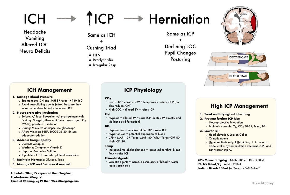 SarahFoohey's tweet photo. On a perpetual quest to simplify ICH/ICP physiology and management for the R3s (and myself!).  Would love some feedback from the #FOAMed #MedEd twitter world to ensure this is up to date and practical 🤓 https://t.co/vOkFgmxJQw