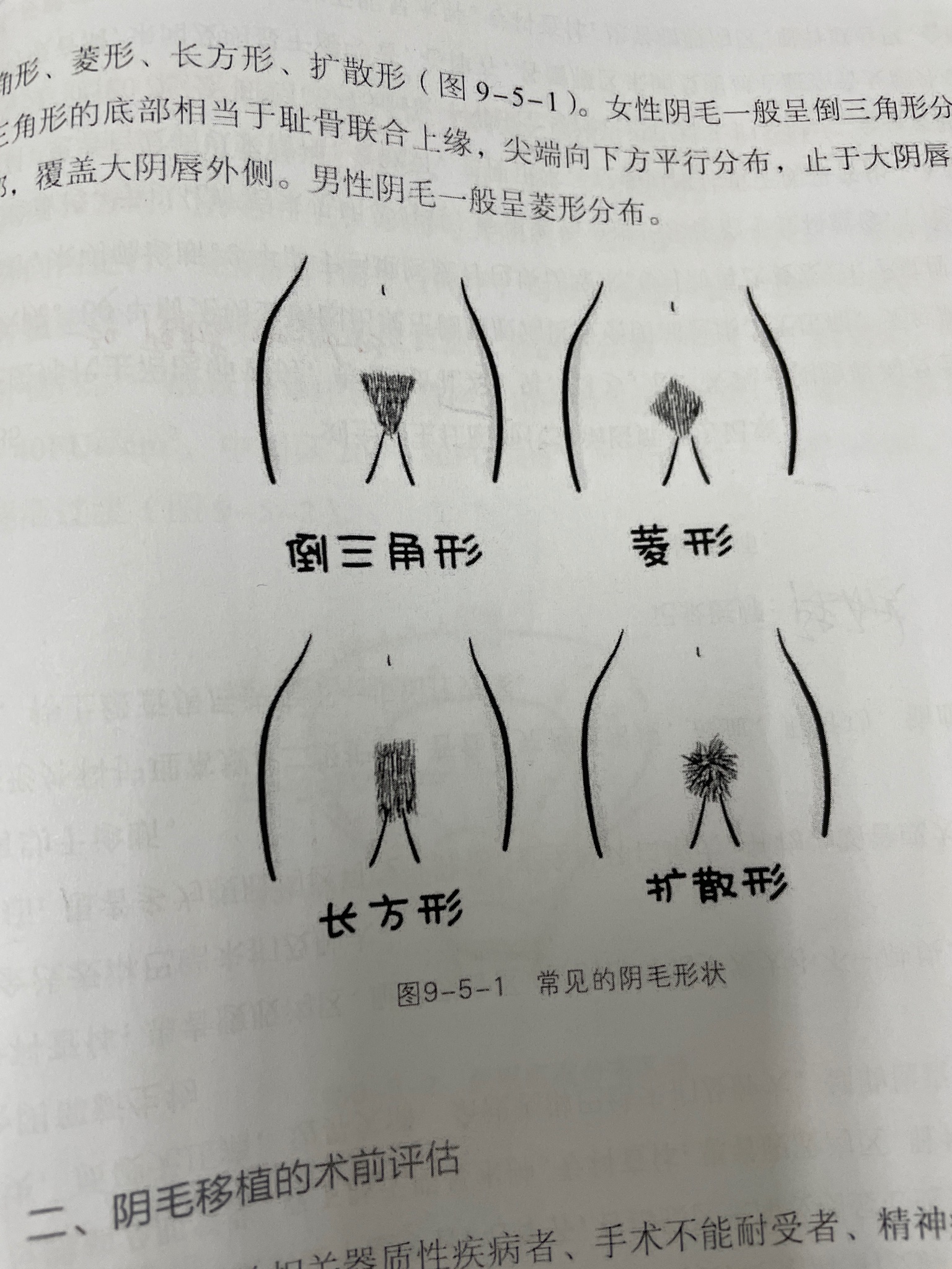 阴毛 
