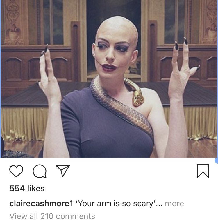 McrHands's tweet photo. One day, our shared human experiences will help us understand our prejudices about disabilities, both visible &amp; hidden.

#TheWitches #NotAWitch #LimbDifference  @BSSHand @McrUpperLimb 

https://t.co/YA7Pf2egXD

https://t.co/9BbsQShxht https://t.co/4l7YSfcGAs