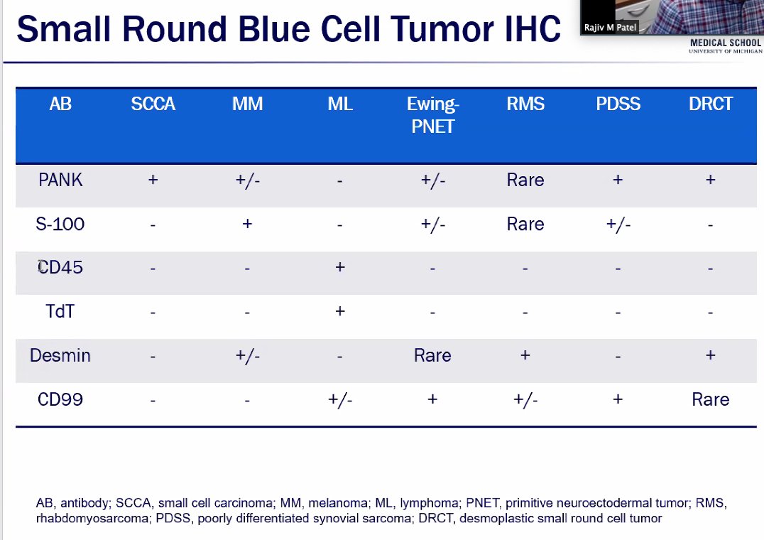SimonRoyMD's tweet image. #ASDP2020 Small round blue cell ddx and workup, soft tissue dermatopathology by Dr. Patel, consultations session.