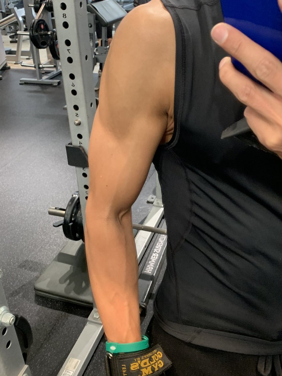 バスキュラリティ